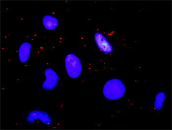 CREBBP monoclonal antibody (M01), clone 2H5