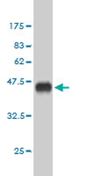 CREBBP monoclonal antibody (M01), clone 2H5
