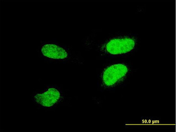 ATF2 monoclonal antibody (M02), clone 1E12