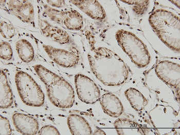 ATF2 monoclonal antibody (M02), clone 1E12