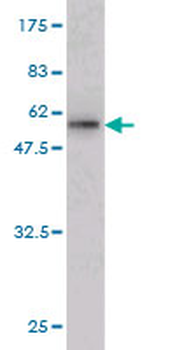 ATF2 monoclonal antibody (M02), clone 1E12