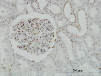 CREB1 monoclonal antibody (M02), clone 5F2