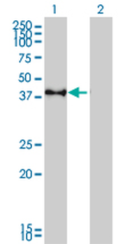 CREB1 monoclonal antibody (M02), clone 5F2