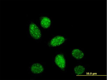CREB1 monoclonal antibody (M01), clone 3F1-1B2