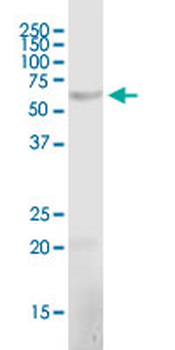 CRAT polyclonal antibody (A01)