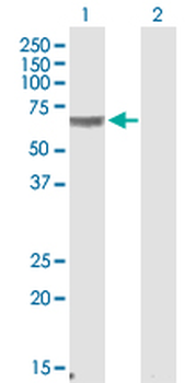CRAT polyclonal antibody (A01)