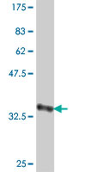 CRAT polyclonal antibody (A01)