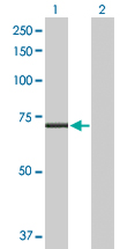 CPT2 purified MaxPab rabbit polyclonal antibody (D01P)