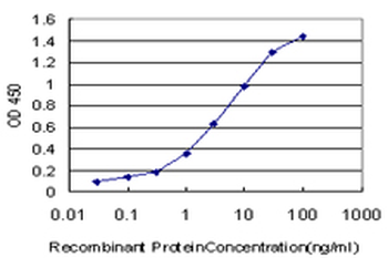 CPS1 monoclonal antibody (M01), clone 8H8