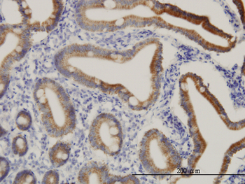 CPS1 monoclonal antibody (M01), clone 8H8