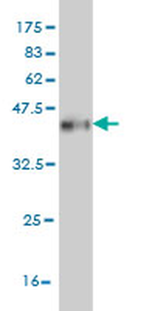 CPS1 monoclonal antibody (M01), clone 8H8