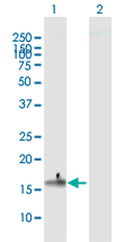 CLDN4 MaxPab mouse polyclonal antibody (B01)