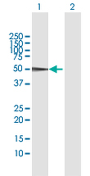 CPB2 MaxPab rabbit polyclonal antibody (D01)