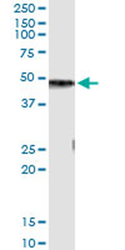 CPB1 monoclonal antibody (M01), clone 4D5
