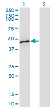 CPB1 monoclonal antibody (M01), clone 4D5