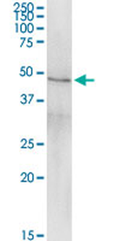 CPB1 MaxPab rabbit polyclonal antibody (D01)