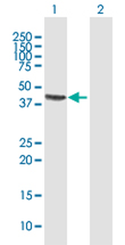 CPB1 MaxPab rabbit polyclonal antibody (D01)