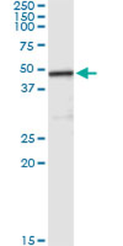 CPA2 monoclonal antibody (M02), clone 2E11