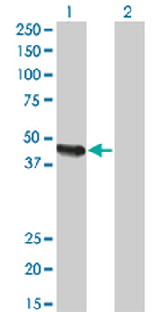 CPA2 monoclonal antibody (M02), clone 2E11