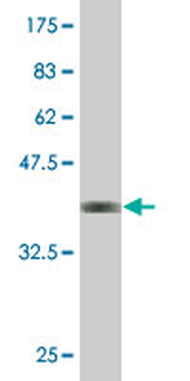 CPA2 monoclonal antibody (M02), clone 2E11