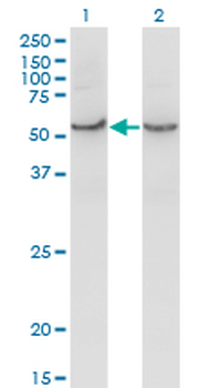 COX15 monoclonal antibody (M01), clone 2D2