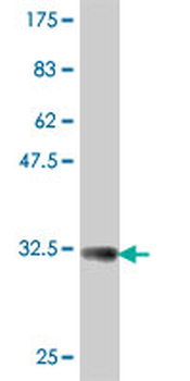 COX15 polyclonal antibody (A01)