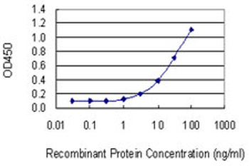 COMT monoclonal antibody (M01), clone 1G4-1A1
