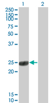 COMT monoclonal antibody (M01), clone 1G4-1A1