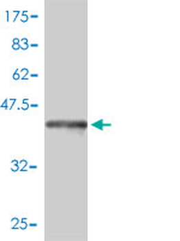 COMT monoclonal antibody (M01), clone 1G4-1A1