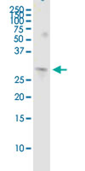 COMT MaxPab rabbit polyclonal antibody (D01)