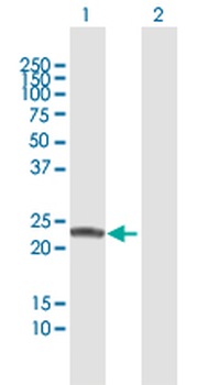 COMT MaxPab rabbit polyclonal antibody (D01)