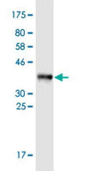 COL19A1 monoclonal antibody (M01), clone 1B2