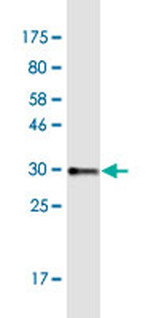 COL8A2 monoclonal antibody (M01), clone 1F4