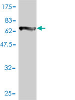 COL6A2 monoclonal antibody (M01), clone 2C5-F2