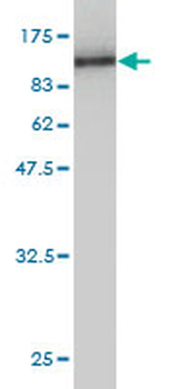 COL5A1 monoclonal antibody (M01), clone 2F4