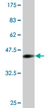 CNR1 monoclonal antibody (M02), clone 1F9
