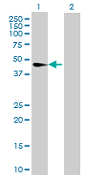 CNP purified MaxPab rabbit polyclonal antibody (D01P)