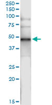 CNP MaxPab rabbit polyclonal antibody (D01)