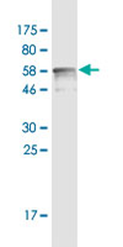 CNN1 monoclonal antibody (M03), clone 3C7-2A6