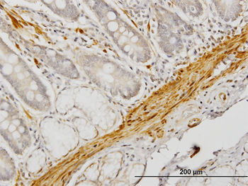 CNN1 monoclonal antibody (M01), clone 2F5-1H4