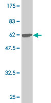CNN1 monoclonal antibody (M01), clone 2F5-1H4