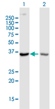CCR5 purified MaxPab mouse polyclonal antibody (B02P)