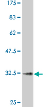 CCR2 monoclonal antibody (M01A), clone 4D12