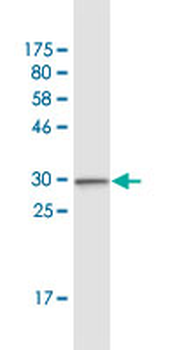 CCR2 monoclonal antibody (M01), clone 4D12