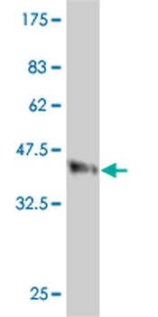 CLTC monoclonal antibody (M05), clone 2E5