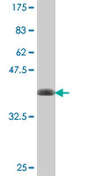 CLTC polyclonal antibody (A01)
