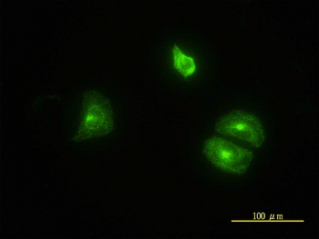 CLTB monoclonal antibody (M01), clone 4B12-1E3
