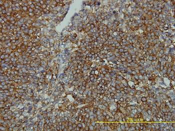 CLTB monoclonal antibody (M01), clone 4B12-1E3