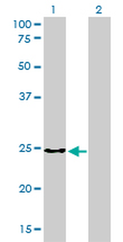CLTB monoclonal antibody (M01), clone 4B12-1E3