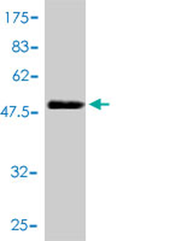 CLTB monoclonal antibody (M01), clone 4B12-1E3